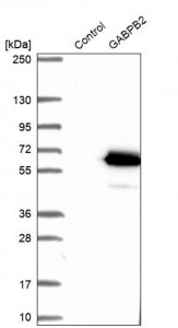 Anti-GABPB2 antibody produced in rabbit 