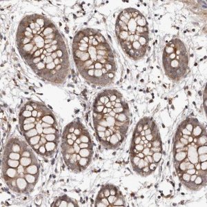 Anti-GABPB2 antibody produced in rabbit 