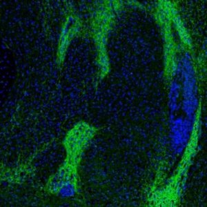 Anti-GABRA3 antibody produced in rabbit 