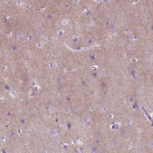 Anti-GABRB2 antibody produced in rabbit 