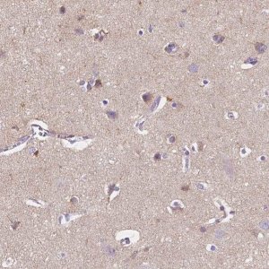 Anti-GABRD antibody produced in rabbit 