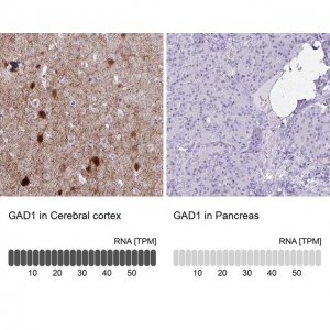 Anti-GAD1 antibody produced in rabbit HPA058412-100UL