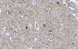 Anti-GAD65 Antibody, clone 3B23 ZooMAb Rabbit Monoclonal 