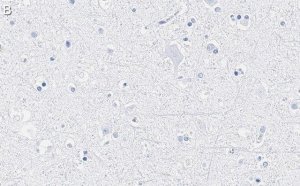 Anti-GAD65 Antibody, clone 3B23 ZooMAb Rabbit Monoclonal 