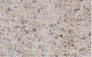 Anti-GAD67 Antibody, clone 1G10.2 ZooMAb Mouse Monoclonal 