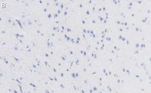 Anti-GAD67 Antibody, clone 1G10.2 ZooMAb Mouse Monoclonal 