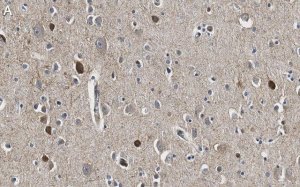 Anti-GAD67 Antibody, clone 4B5 ZooMAb Rabbit Monoclonal 