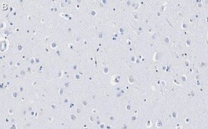 Anti-GAD67 Antibody, clone 4B5 ZooMAb Rabbit Monoclonal 