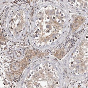 Anti-GADD45B antibody produced in rabbit 