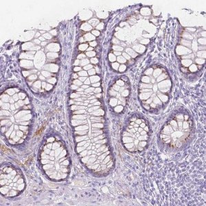Anti-GAL3ST2 antibody produced in rabbit 