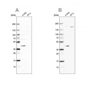 Anti-GALK1 antibody produced in rabbit 