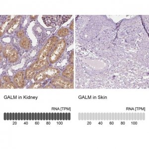 Anti-GALM antibody produced in rabbit HPA035473-100UL