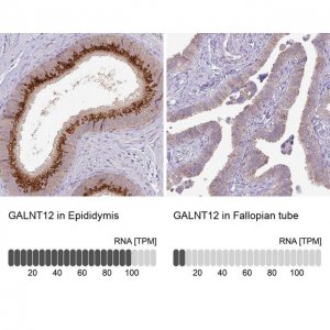 Anti-GALNT12 antibody produced in rabbit 