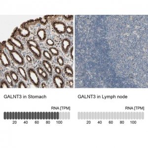 Anti-GALNT3 antibody produced in rabbit 