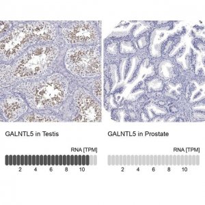 Anti-GALNTL5 antibody produced in rabbit 