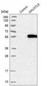 Anti-GALNTL5 antibody produced in rabbit 