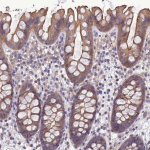 Anti-GALR2 antibody produced in rabbit 