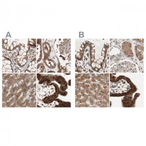 Anti-GALT antibody produced in rabbit 