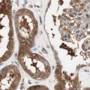 Anti-GALT antibody produced in rabbit 