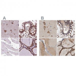 Anti-GANAB antibody produced in rabbit 