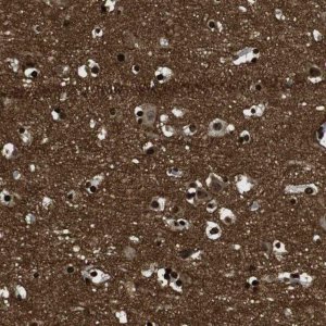 Anti-GAP43 antibody produced in rabbit 