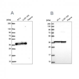 Anti-GAPDH antibody produced in rabbit HPA061280-100UL