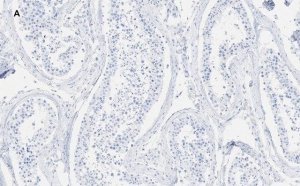 Anti-GAPDH Antibody, clone 10B13, ZooMAb Rabbit Monoclonal 