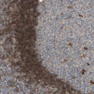 Anti-GAPT antibody produced in rabbit HPA011070-100UL