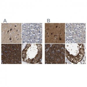 Anti-GARS antibody produced in rabbit 