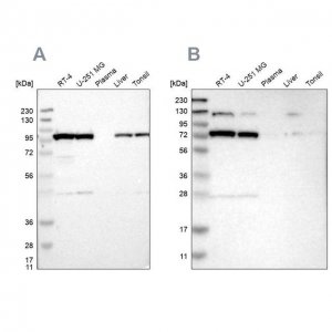 Anti-GARS antibody produced in rabbit 