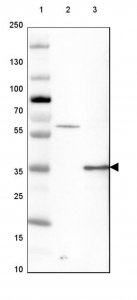 Anti-GATAD1 antibody produced in rabbit HPA006105-100UL