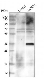 Anti-GATAD1 antibody produced in rabbit HPA006105-100UL