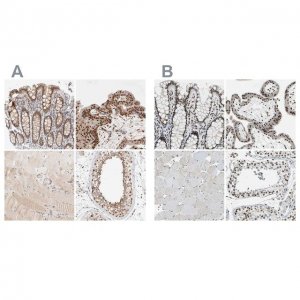 Anti-GATAD2A antibody produced in rabbit 
