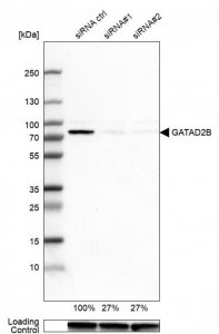 Anti-GATAD2B antibody produced in rabbit 