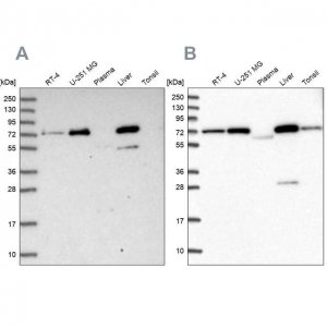 Anti-GBE1 antibody produced in rabbit HPA038073-100UL