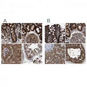 Anti-GCC1 antibody produced in rabbit 