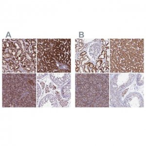 Anti-GCDH antibody produced in rabbit 