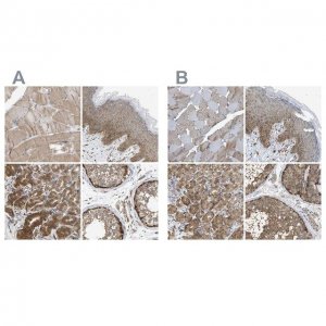 Anti-GCN1 antibody produced in rabbit HPA019648-100UL