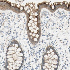 Anti-GCNT3 antibody produced in rabbit 