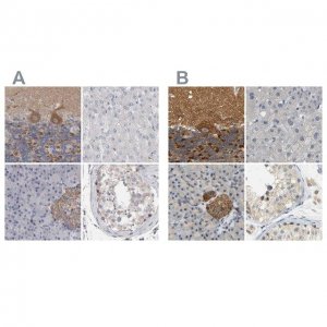 Anti-GDAP1 antibody produced in rabbit 