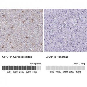 Anti-GFAP antibody produced in rabbit HPA056030-100UL