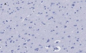 Anti-GFAP Antibody, clone 2E8, ZooMAb Rabbit Monoclonal 