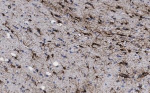 Anti-GFAP Antibody, clone 2E8, ZooMAb Rabbit Monoclonal 
