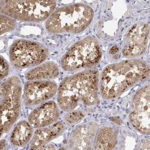 Anti-GGACT antibody produced in rabbit 