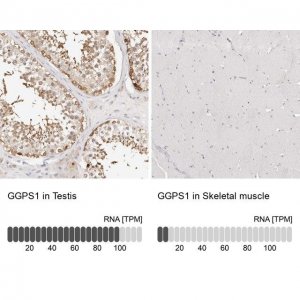 Anti-GGPS1 antibody produced in rabbit HPA029472-100UL