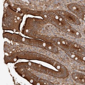 Anti-GHDC antibody produced in rabbit HPA031650-100UL