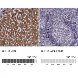 Anti-GHR antibody produced in rabbit 
