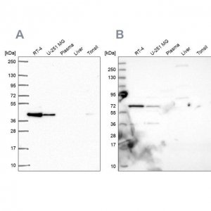 Anti-GIPC1 