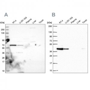 Anti-GIPC1 antibody produced in rabbit 