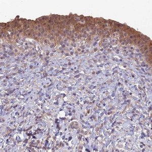 Anti-GIPC1 antibody produced in rabbit 